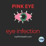 Understanding Eye Infections: Causes, Symptoms, and Treatments
